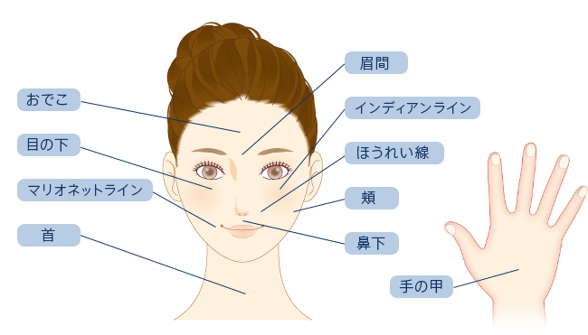 該当の部位と症状：おでこ、眉間、目の下、インディアンライン、ほうれい線、マリオネットライン、頬、鼻下、首、手の甲