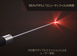 BEAUTIFILL™（ビューティフィル）の特長　360度ラディアルエミッションによるレーザー照射