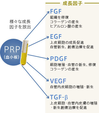 PRP（血小板）様々な成長因子を放出　【成長因子】FGF:組織を修復、コラーゲンの産生、ヒアルロン酸の産生 EGF:上皮細胞の成長促進、血管新生、創傷治療を促進 PDGF:細胞増殖・血管の新生、修復、コラーゲンの産生 VEGF:血管内皮細胞の増殖・新生 TGF-β:上皮細胞・血管内皮膚の増殖・新生創傷治癒を促進