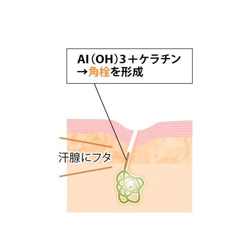 AI(OH)3+ケラチン→角栓を形成
