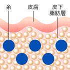 横断面図