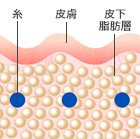 横断面図