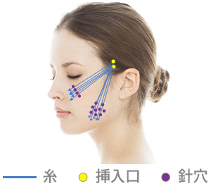 挿入位置