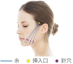 挿入位置