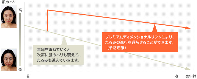 年齢を重ねていくと次第に肌のハリも衰えて、たるみも進んでいきます。プレミアムディメンショナルリフトにより、たるみの進行を遅らせることができます。（予防治療）