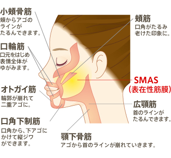 SMAS（表在性筋膜）　頬筋:口角がたるみ老けた印象に。 小頬骨筋:頬からアゴのラインがたるんできます。 口輪筋:口元をはじめ表情全体がゆがみます。 オトガイ筋:輪郭が崩れて二重アゴに。 口角下制筋:口角から、下アゴにかけて縦ジワができます。 顎下骨筋:アゴから首のラインが崩れていきます。
