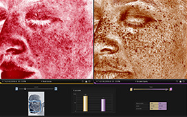 皮膚の色の解析イメージ