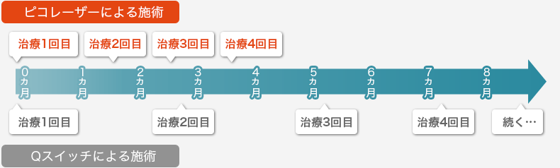 ピコレーザーによる施術 Qスイッチによる施術