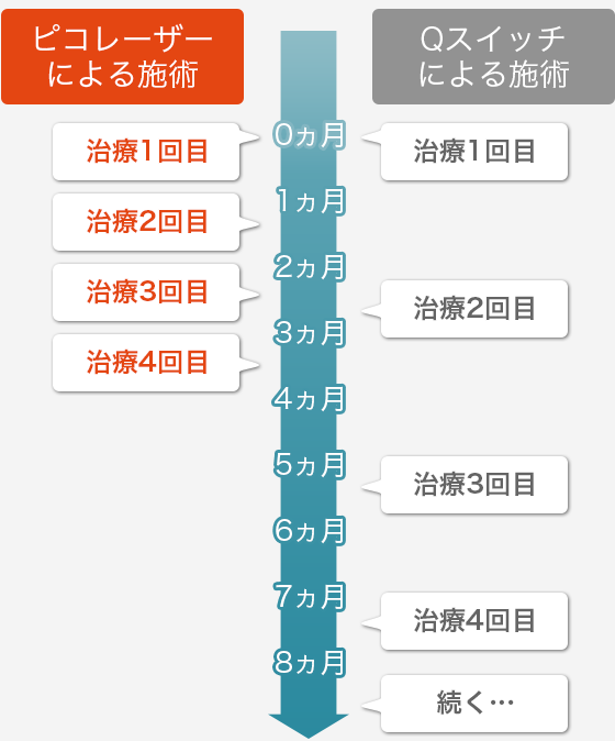 ピコレーザーによる施術 Qスイッチによる施術