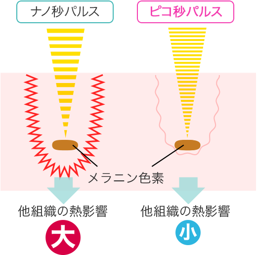 ナノ秒パルス → 他組織の熱影響 大 ピコ秒パルス → 他組織の熱影響 小