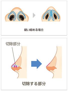 手術