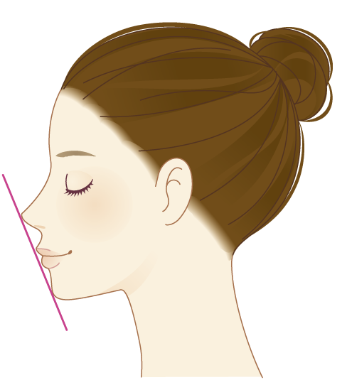 鼻尖形成 耳介軟骨移植 鼻の整形 美容整形 美容外科 美容皮膚科なら聖心美容クリニック