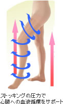 医療用弾性ストッキング ストッキングの圧力で心臓への血液循環をサポート