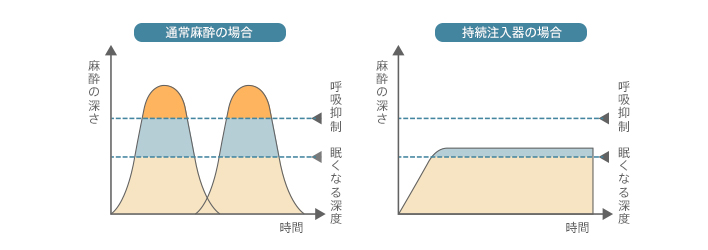 グラフ：通常麻酔、持続注入器の場合の麻酔の深さ