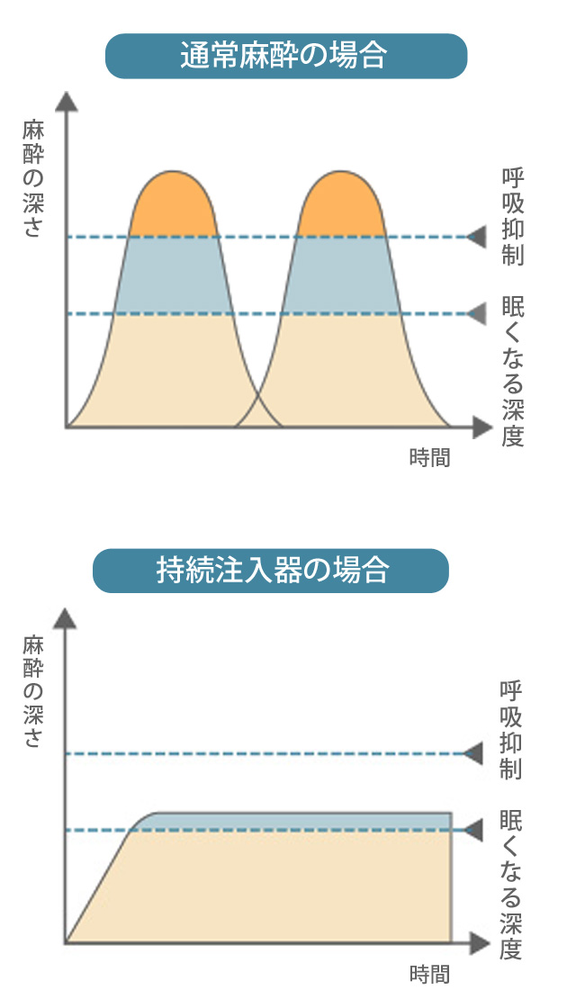 グラフ：通常麻酔、持続注入器の場合の麻酔の深さ