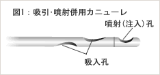 図1:吸引・噴射併用カニューレ