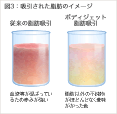 図3:吸引された脂肪のイメージ　【従来の脂肪吸引】血液等が混ざっているため赤みが強い。【ボディジェット脂肪吸引】脂肪以外の不純物がほとんどなく黄味がかった色