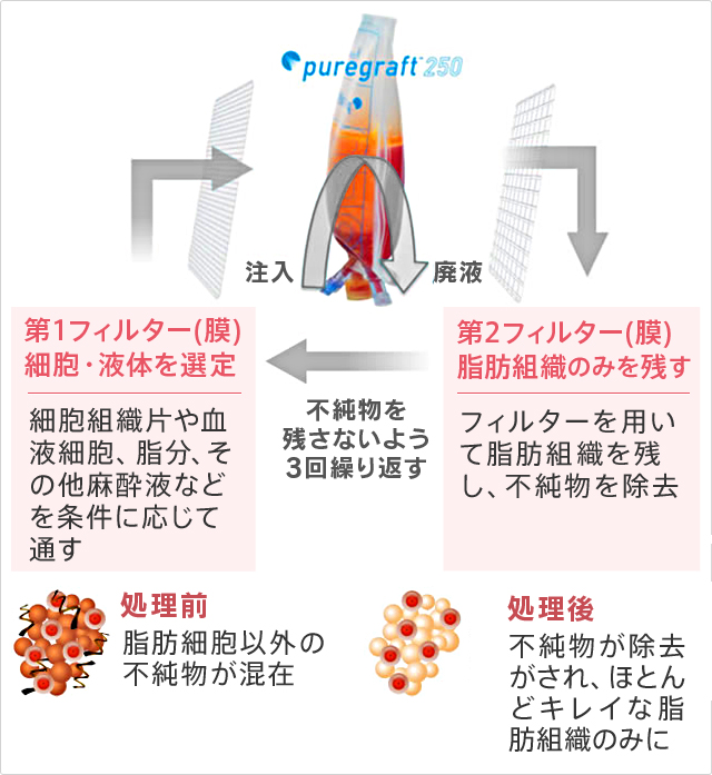 ピュアグラフトの高性能フィルター