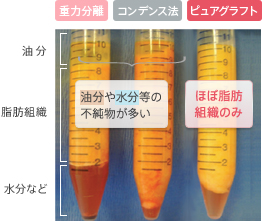 重力分離とコンデンス法は油分や水分等の不純物が多い。ピュアグラフトはほぼ脂肪組織のみ