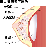 イメージ図