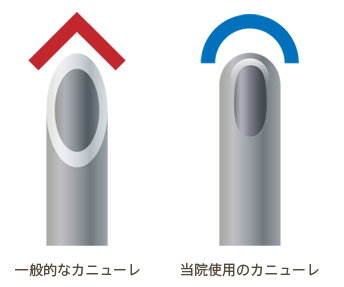 一般的なカニューレ、当院使用のカニューレ