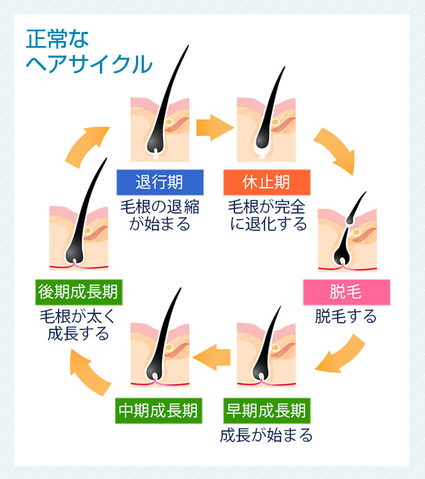 正常なヘアサイクル 早期成長期 成長が始まる 中期成長期 後期成長期 毛根が太く成長する 退行期 毛根の退縮が始まる 休止期 毛根が完全に退化する 脱毛 脱毛する