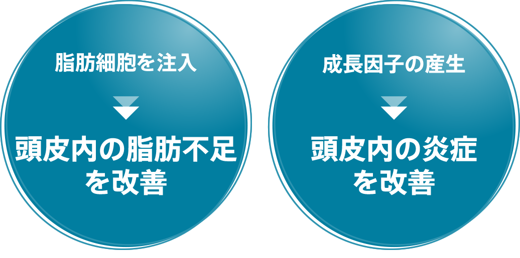 脂肪細胞を注入 頭皮内の脂肪不足を改善 成長因子の産生 頭皮内の炎症を改善