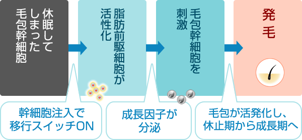 休眠してしまった毛包幹細胞 幹細胞注入で移行スイッチON 脂肪前駆細胞が活性化 成長因子が分泌 毛包幹細胞を刺激 毛包が活発化し、休止期から成長期へ 発毛