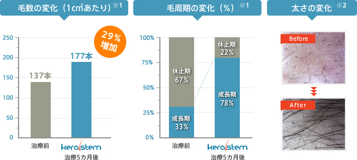 毛数の変化 毛周期の変化 太さの変化