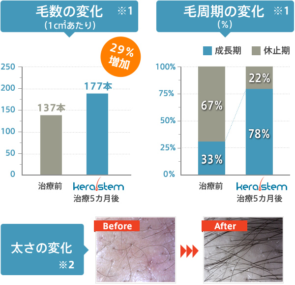 毛密度の変化（使用前との比較） ケラステム 37%