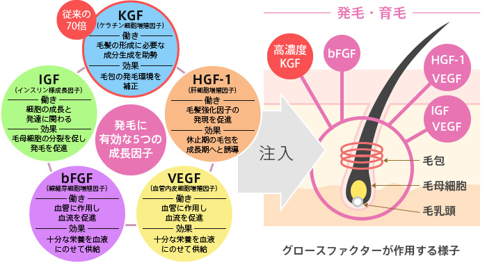 従来の70倍 KGF(ケラチン細胞増殖因子) -働き- 毛髪の形成に必要な成分生成を助勢 -効果- 毛包の発毛環境を補正 HGF-1(肝細胞増殖因子) -働き- 毛髪強化因子の 発現を促進 -効果- 休止期の毛包を成長期へと誘導 VEGF(血管内皮細胞増殖因子) -働き- 血管に作用し血流を促進 -効果- 十分な栄養を血液にのせて供給 bFGF(線維芽細胞増殖因子) -働き- 血管に作用し血流を促進 -効果- 十分な栄養を血液にのせて供給 IGF(インスリン様成長因子) -働き- 細胞の成長と発達に関わる -効果- 毛母細胞の分裂を促し発毛を促進 発毛に有効な5つの成長因子 注入 発毛・育毛 グロースファクターが作用する様子