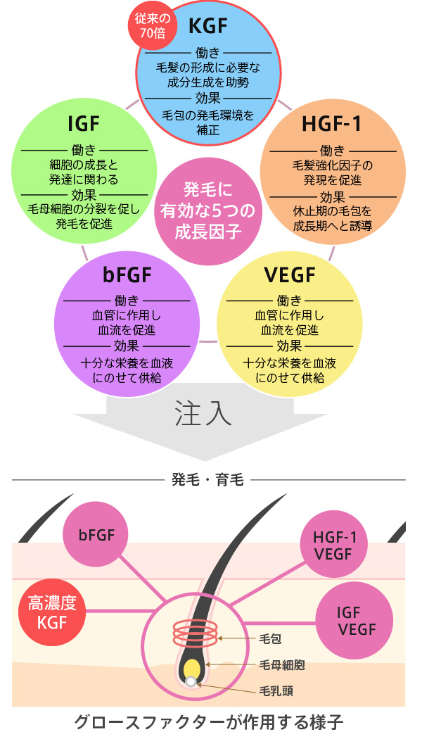 従来の70倍 KGF(ケラチン細胞増殖因子) -働き- 毛髪の形成に必要な成分生成を助勢 -効果- 毛包の発毛環境を補正 HGF-1(肝細胞増殖因子) -働き- 毛髪強化因子の 発現を促進 -効果- 休止期の毛包を成長期へと誘導 VEGF(血管内皮細胞増殖因子) -働き- 血管に作用し血流を促進 -効果- 十分な栄養を血液にのせて供給 bFGF(線維芽細胞増殖因子) -働き- 血管に作用し血流を促進 -効果- 十分な栄養を血液にのせて供給 IGF(インスリン様成長因子) -働き- 細胞の成長と発達に関わる -効果- 毛母細胞の分裂を促し発毛を促進 発毛に有効な5つの成長因子 注入 発毛・育毛 グロースファクターが作用する様子