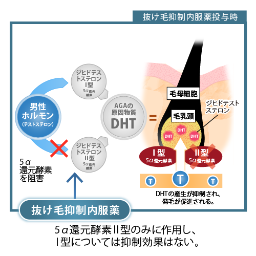 抜け毛抑制内服薬投与時 抜け毛抑制内服薬 5α還元酵素Ⅱ型のみに作用し、Ⅰ型については抑制効果はない。