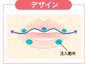 注入箇所