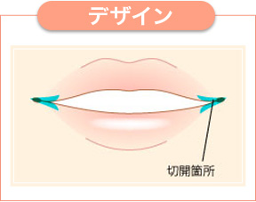 唇 腫れ 痛く ない