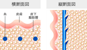 一般的な糸の通し方 横断面図 縦断面図