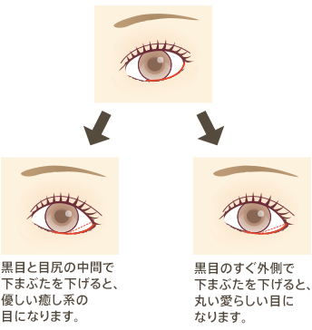 たれ目形成 グラマラスライン 下眼瞼下制術 二重まぶた 目頭切開 涙袋 眼瞼下垂 美容整形 美容外科 美容皮膚科なら聖心美容クリニック