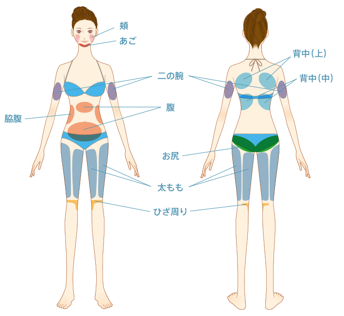 頬、あご、二の腕、腹、脇腹、太もも、ひざ周り、背中（上）、背中（中）、お尻