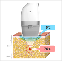 皮膚：5℃、焦点部位70℃