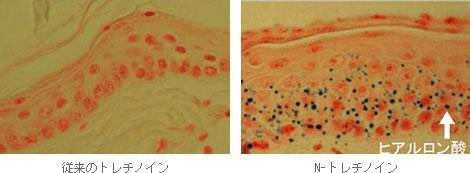 従来のトレチノインとN-トレチノインのヒアルロン酸生成比較画像