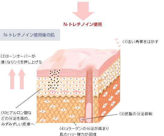 N-トレチノイン使用後の肌：(1)古い角質をはがす(2)ターンオーバーが速くなりシミを押し上げる(3)皮脂の分泌抑制(4)コラーゲンの分泌が高まり肌のハリ・弾力が回復(5)ヒアルロン酸などの分泌を高め、みずみずしい皮膚へ