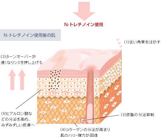 N-トレチノイン使用後の肌