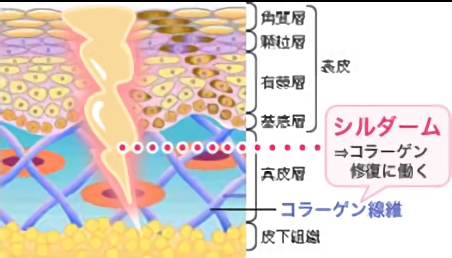 シルダーム ⇒ コラーゲン修復に働く