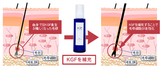 自身ではKGF産生が難しくなった毛根→KGFを補充→KGFを補充することで毛母細胞が活性化