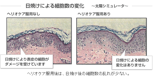 日焼けによる細胞数の変化 ～太陽シミュレータ～ ヘリオケア服用なし 日焼けにより表皮の細胞がダメージを受けています ヘリオケア服用あり 日焼けによる細胞の変化はありません