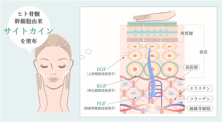 ヒト骨髄幹細胞由来サイトカインを塗布