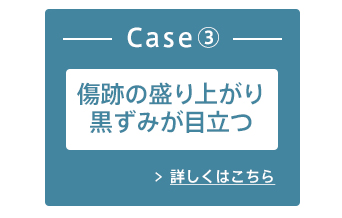 Case3:傷跡の盛り上がり、黒ずみが目立つ 詳しくはこちら