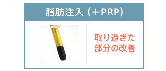 脂肪注入（+PRP）:取り過ぎた部分の改善