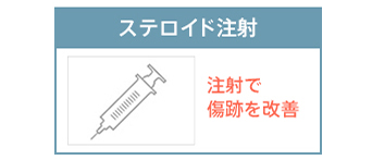 ステロイド注射:注射で傷跡を改善