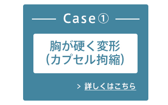 Case①胸が硬く変形（カプセル拘縮） 詳しくはこちら